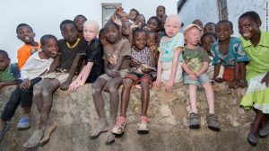 Albino Tribe Butchered for Black Magic Medicine